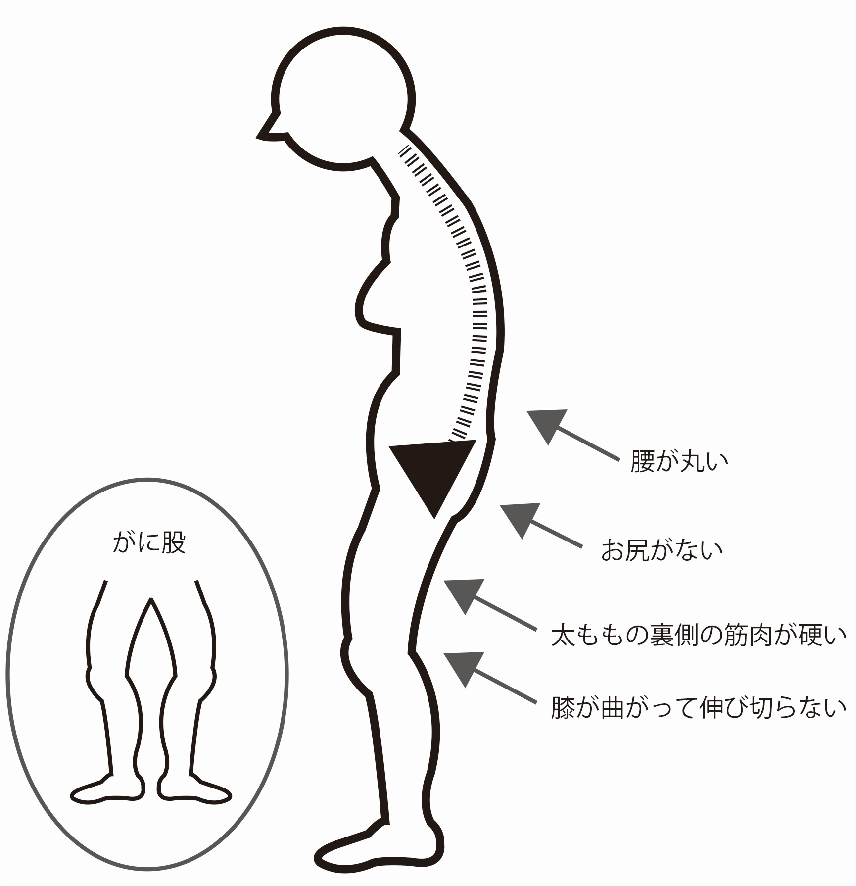 骨盤の前傾 後傾 あなたはどっち ５秒でできる簡単チェック法と ２つの矯正ストレッチ 整体ショーツ公式サイト 骨盤補正ショーツ 骨盤ショーツ 腰がスーッとなるショーツ