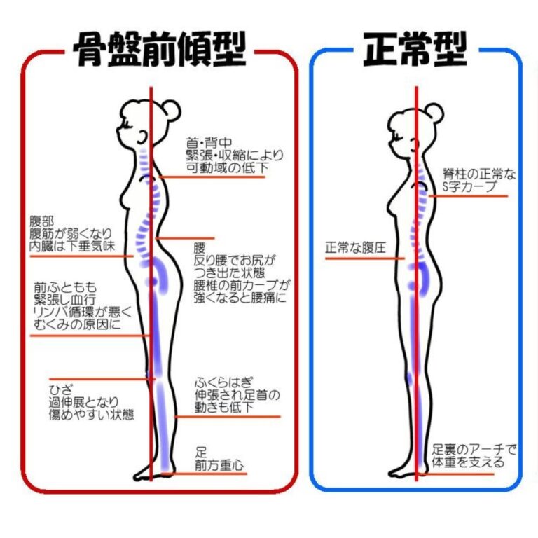 反り腰改善へ!タオルを使い骨盤を立てる座り方で腰痛予防|整体ショーツ公式サイト/はくだけ整体シリーズ
