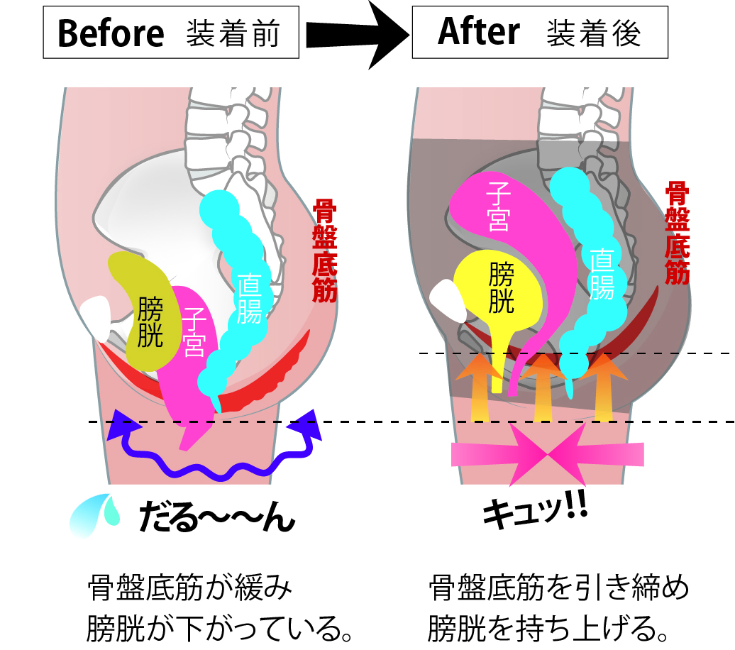 骨盤リフォーム™構造のパワーネット